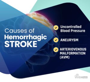 Best Hemorrhagic Stroke Treatment