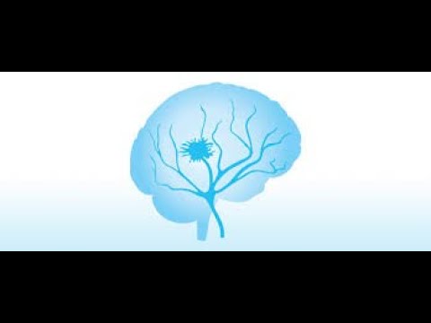 Best Interventional Neuroradiologist in Mohali