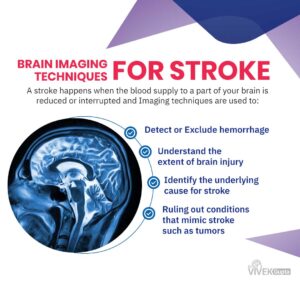 Brain Imaging Techniques for Stroke - Dr. Vivek Gupta