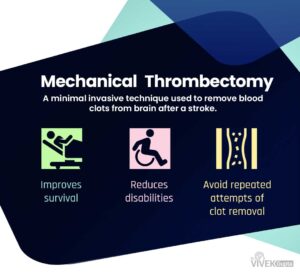 Best Mechanical Thrombectomy Procedure For Stroke in Mohali