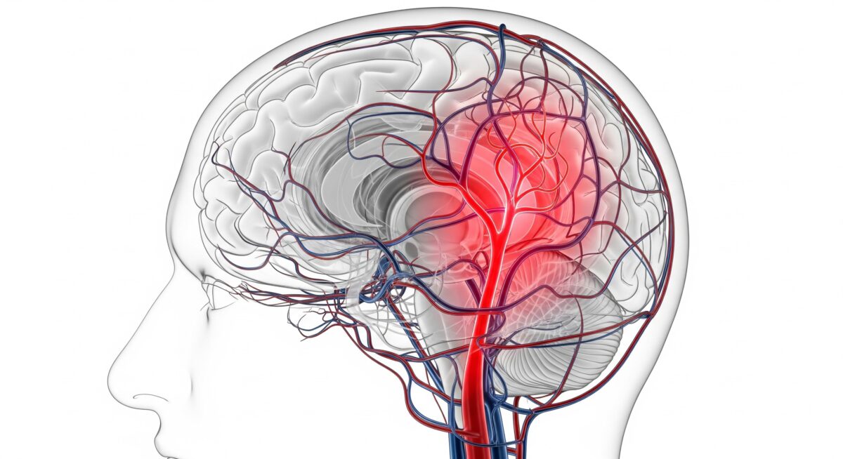 Best Interventional Neuroradiologist in Mohali